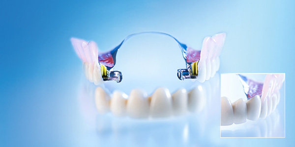 Gaumenplatte zahnersatz Zahnprothese: Alle